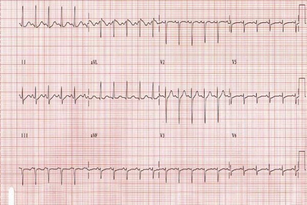 Krab10 cc мотоботы купить недорого
